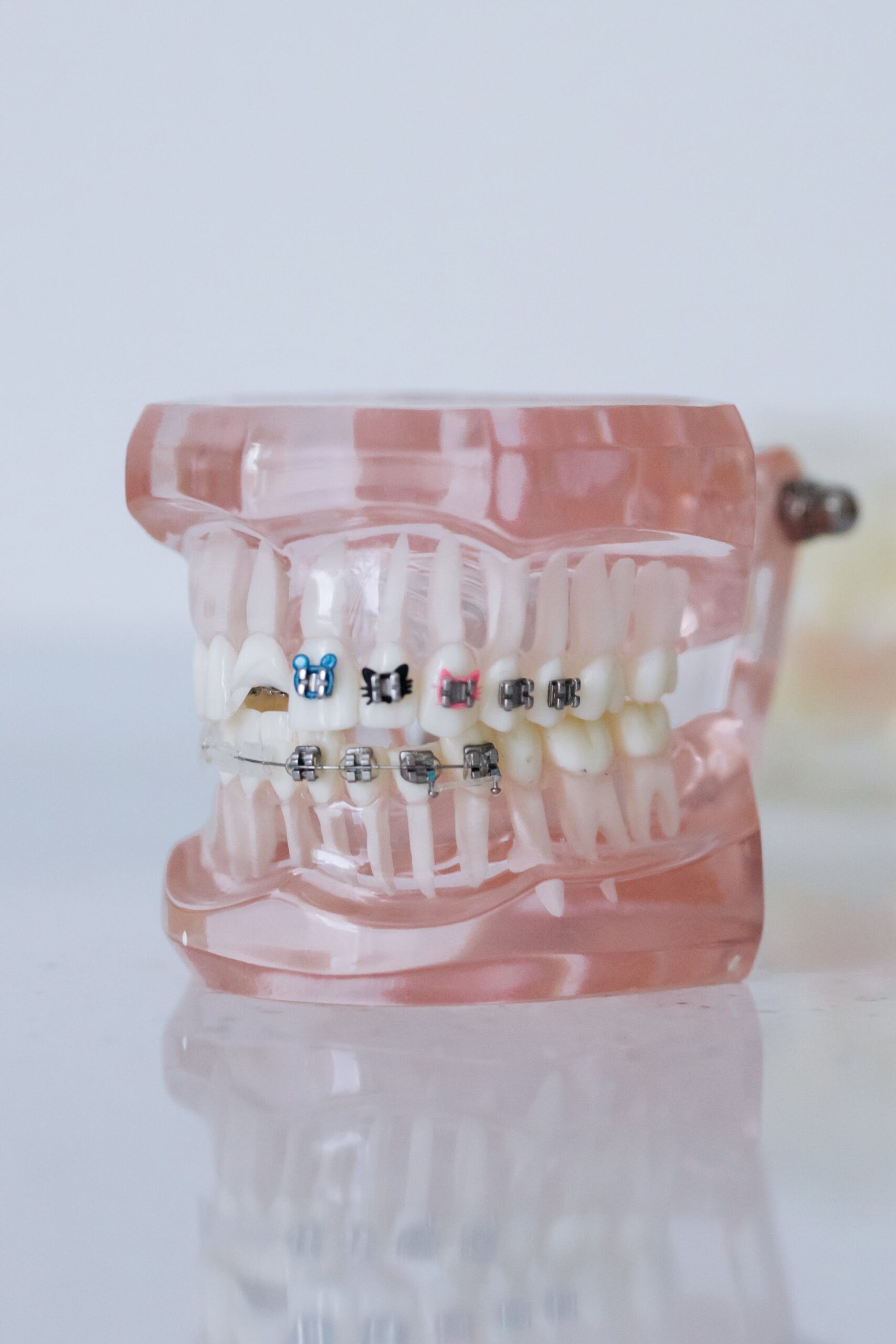 Braces and Teeth Cleaning in Las Vegas